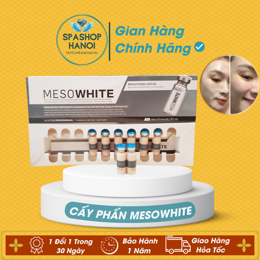 Phấn Mesowhite, Cấy Phấn Mesowhite Chính Hãng