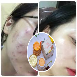 KEM FACE NGHỆ TƯƠI 15gram