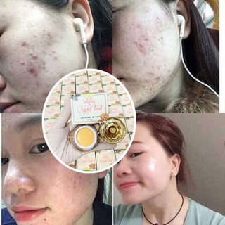 KEM FACE NGHỆ TƯƠI 15gram