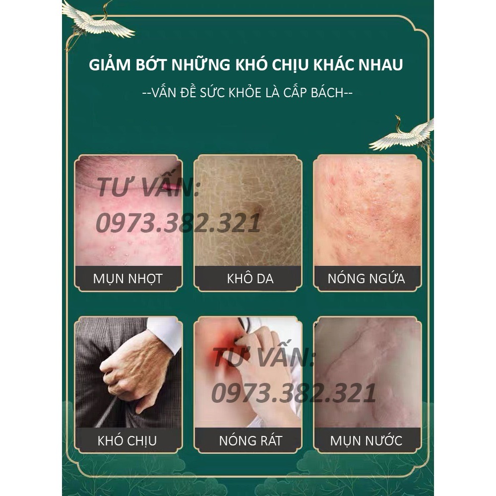 Kem Bôi Viêm Da Cơ Địa Nấm Ngứa BỌ CẠP Hắc Lào, Tổ Đỉa, Vẩy Nến, Á Sừng, Lang Ben Hiệu Quả