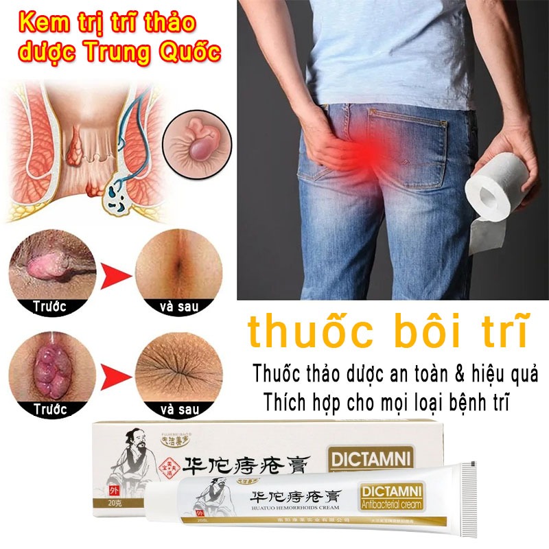 Kem bôi giảm các triệu chứng của trĩ và teo đau sưng tấy làm sạch, Đánh Bay Nứt Hậu Mômkháng khuẩn,Loại bỏ bệnh nội