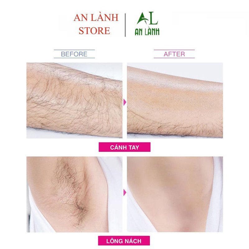 Kem tẩy lông HOBEBAR 50g và Gel dưỡng lô hội 30g dịu nhẹ da không gây kích ứng và không đau rát tẩy lông chân tay nách