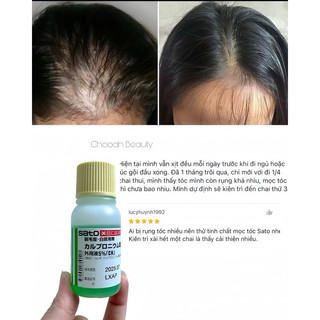 Tinh chất kích thích mọc tóc Sato Nhật 30ml