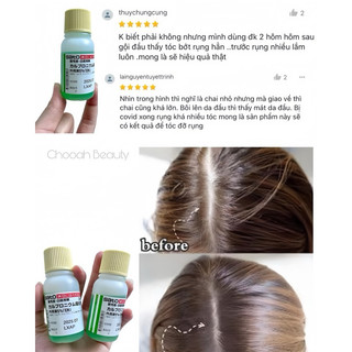Tinh chất kích thích mọc tóc Sato Nhật 30ml