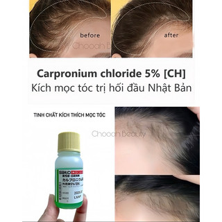 Tinh chất kích thích mọc tóc Sato Nhật 30ml
