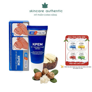 Kem đồi mồi tay chân kpem nga, giảm gân tay, chống lão hóa, dưỡng da tay