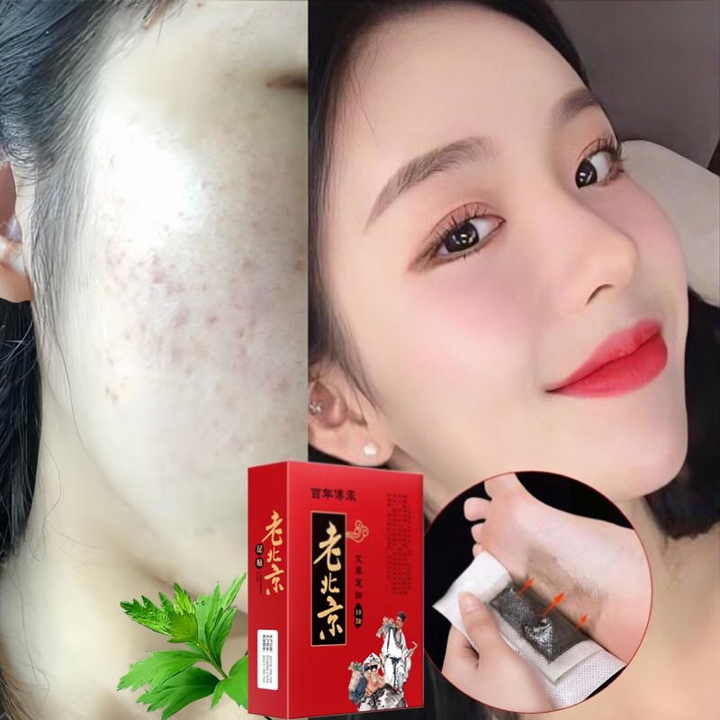 [LOẠI 1] Miếng dán thải độc chân, hộp 50 miếng dán thải độc, cải thiện giấc ngủ, tê bì chân tay.