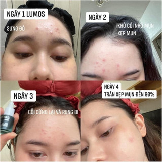 Serum Lumos Ance 5ml - ALISA