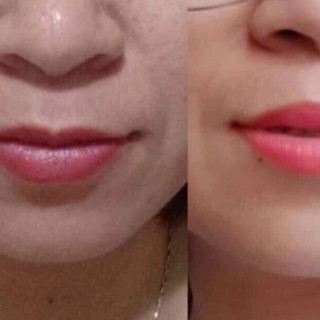 Dưỡng kích màu sau phun ( mỹhương) giảm thâm môi nhanh chóng chỉ sau 5 ngày sử dụng