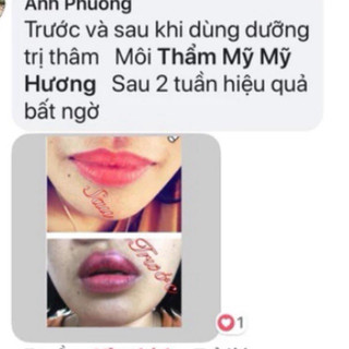 Dưỡng kích màu sau phun ( mỹhương) giảm thâm môi nhanh chóng chỉ sau 5 ngày sử dụng