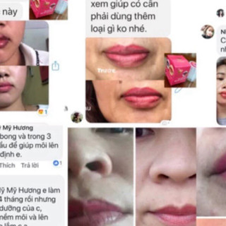 Dưỡng kích màu sau phun ( mỹhương) giảm thâm môi nhanh chóng chỉ sau 5 ngày sử dụng