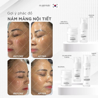 Kem Dưỡng 𝐂𝐎𝐌𝐅𝐎𝐑𝐓 𝐕𝐈𝐓𝐀 𝐊+