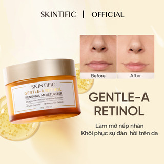   Mua 1 tặng quà  Kem dưỡng ẩm dịu nhẹ chống lão hóa Gentle-A Retinol SKINTIFIC 30g 