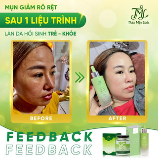 [CHÍNH HÃNG] Combo Đông Y Thảo Mộc Linh.