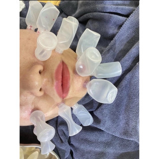 Combo 100 ống nhựa hút mụn, ống hút màu bầm dùng trong spa, tmv