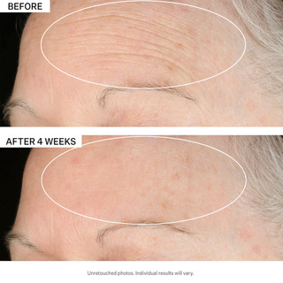 StriVectin ⚜️ Kem dưỡng chống lão hoá  SD Advanced ™ PLUS Intensive Moisturizer
