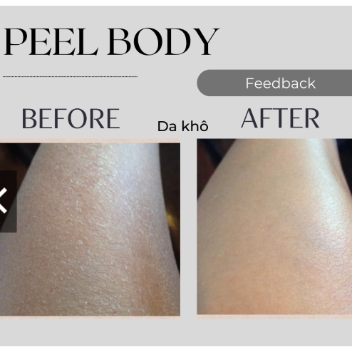 Tinh Chất Lycos White Dưỡng Body BHA AHA - Lycos White body lotion Không Bong Tróc Dưỡng Body mịn màng, trắng sáng