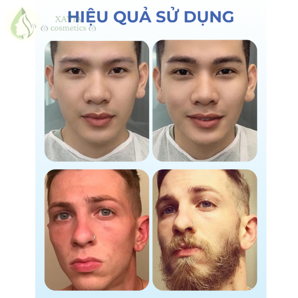 Huyết thanh mọc lông mày, râu tóc siêu tốc ANRAN, Giúp mọc nhanh, Ngăn ngừa rụng, Thu hút mọi ánh nhìn - XAVIA COSMETICS