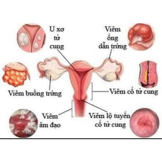 Thảo Mộc Quả Cầu Cung Điện Nga