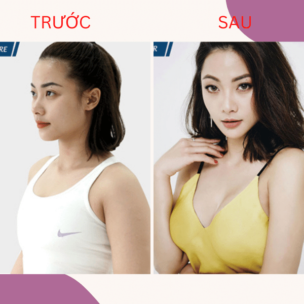 Viên sủi nở ngực LADY PLUS GOLD săn chắc tăng size vòng 1, hồng nhũ hoa hiệu quả tức thì hộp 20 viên