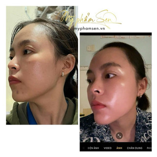 Kem dưỡng siêu vi kim