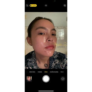 Kem dưỡng siêu vi kim