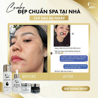 Combo phục hồi & sạch thâm nám