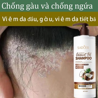 Dầu gội dầu dầu gội cho da dầu dầu gội gàu dầu gội nấm da đầu cải thiện tóc hư tổn Chống ngứa, gàu