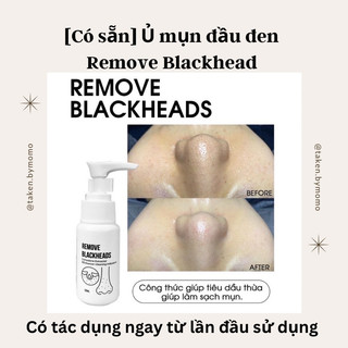 Ủ mụn đầu đen remove blackhead