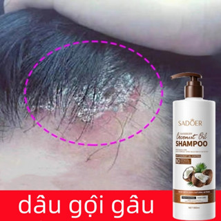 dầu gội dừa dầu gội gầu dầu gội nấm da đầu giảm ngứa làm sạch sâu da đầu Làm mới kiểm soát