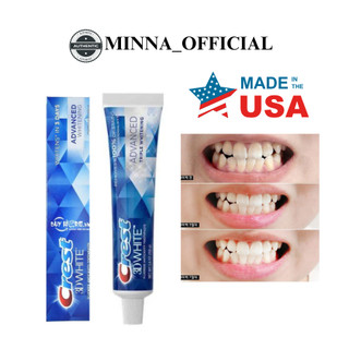 Kem đánh răng crest 3d white advanced whitening 147g mỹ