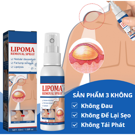 Xịt Trị U Mỡ Loại Bỏ Mỡ Thừa Làm Đẹp Cơ Thể Nhanh Chóng Dành Cho Nam Và Nữ | BigBuy360 - bigbuy360.vn