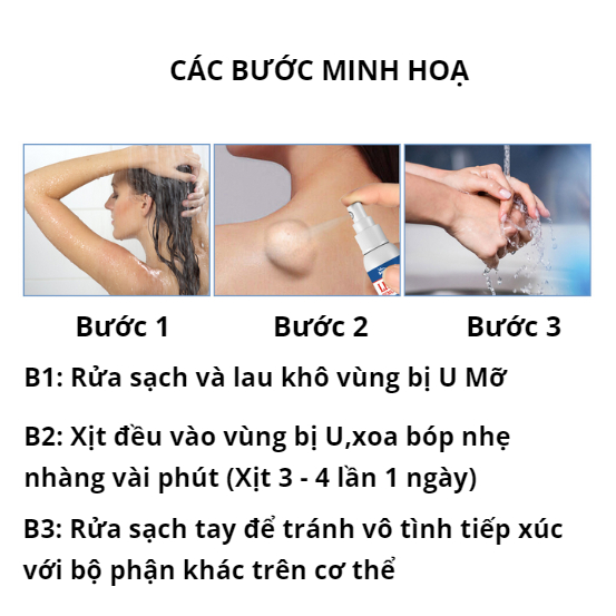 Xịt Trị U Mỡ Loại Bỏ Mỡ Thừa Làm Đẹp Cơ Thể Nhanh Chóng Dành Cho Nam Và Nữ | BigBuy360 - bigbuy360.vn