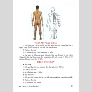 Sách - Học Châm Cứu Bằng Hình Ảnh (Tái Bản Có Chỉnh Sửa Bổ Sung)
