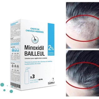 Xịt mọc tóc Minoxidil Bailleul 2% hàng Pháp