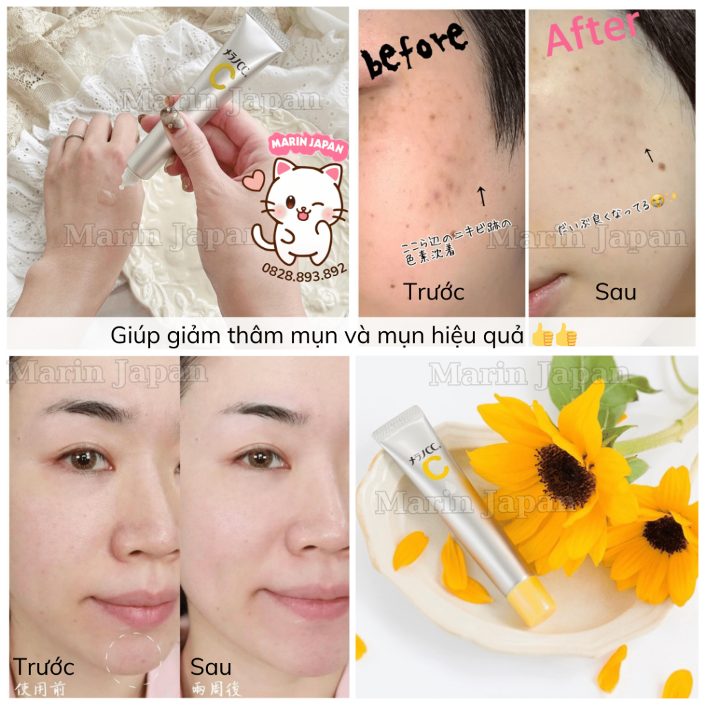 Serum Melano CC Nhật Bản Hỗ Trợ Thâm Mụn, Thâm Nám, Giúp Dưỡng Trắng