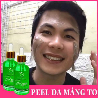 Peel da royce skin m+ peel da sành điệu nhất