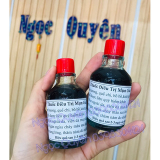 Chấm mụn gia truyền