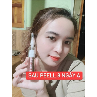 PEEL DA ĐÔNG TRÙNG HUYỀN PHI