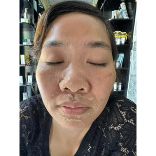 PEEL DA ĐÔNG TRÙNG HUYỀN PHI