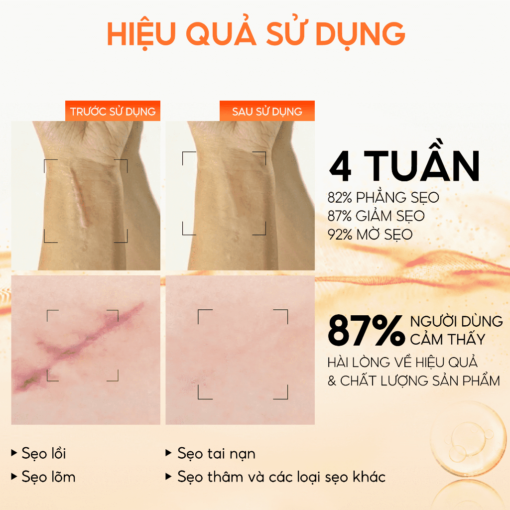 [COMBO 2 TUÝP] Kem mờ sẹo, liền sẹo, các loại sẹo lồi, sẹo lõm, sẹo bỏng, sẹo tai nạn - Kem liền sẹo nghệ đỏ Scar Abera