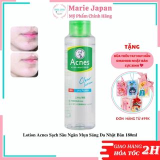 Lotion Acnes Sạch Sâu Ngừa Mụn Sáng Da Nhật Bản 180ml