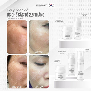 Kem Dưỡng 𝐂𝐎𝐌𝐅𝐎𝐑𝐓 𝐕𝐈𝐓𝐀 𝐊+