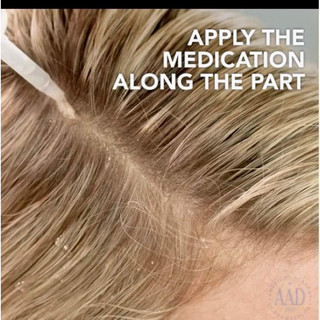 DEMOVATE scalp application tháilan 🇹🇭🇹🇭