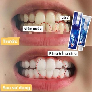 [Mẫu mới] Kem đánh răng Crest 3D White Advanced Triple Whitening Mỹ