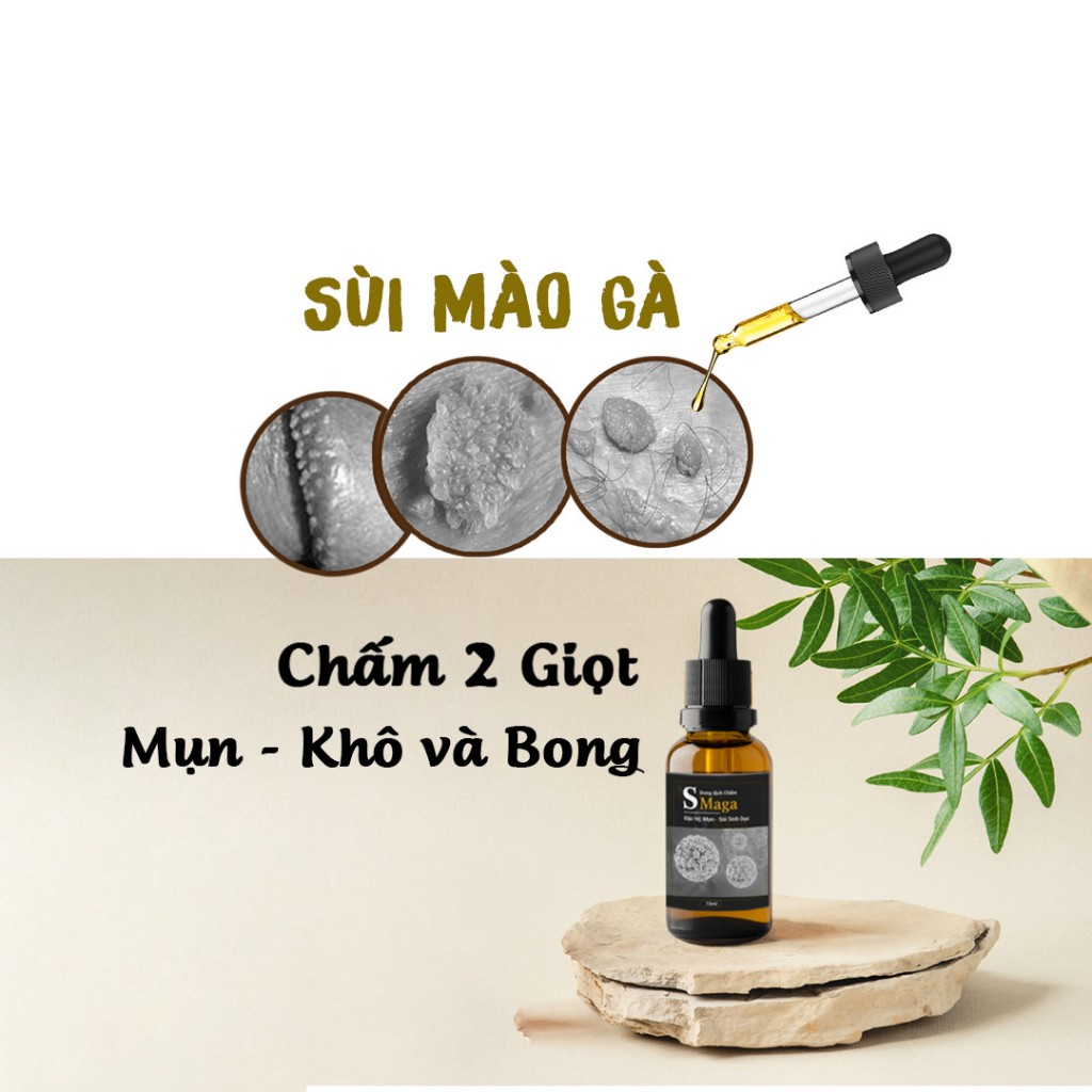 SMAGA 60% chính hãng giúp loại bỏ sùi mào gà,mụn sinh duc,hạt ngọc dv sau 6 ngày sử dụng sản phẩm an toàn(có che tên)