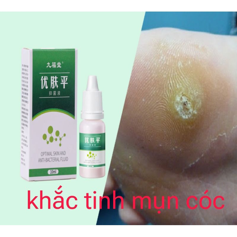 TẨY MỤN CÓC, XÓA MỤN CÓC (Gensohei) 10ml