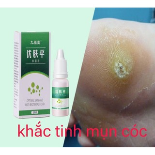 Tẩy mụn cóc, xóa mụn cóc 10ml