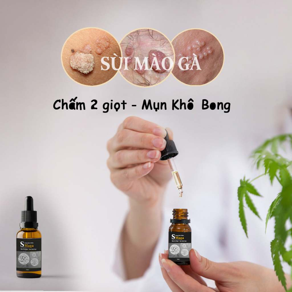 COMBO UỐNG+BÔI THỔI BAY SÙI MÀO GÀ-SMAGA(CÓ CHE TÊN SẢN PHẨM)