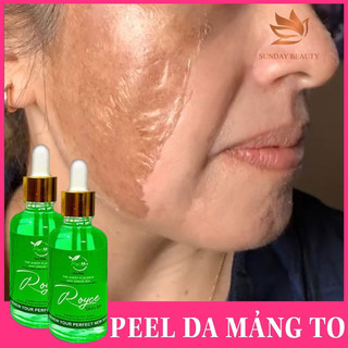 Peel da royce skin m+ peel da đơn giản tại nhà